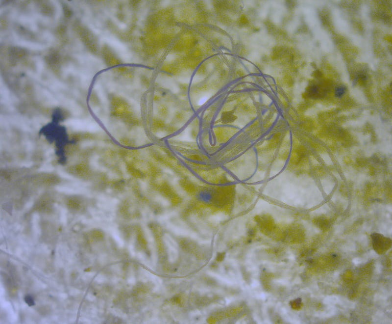 Microplastics viewed under a microscope