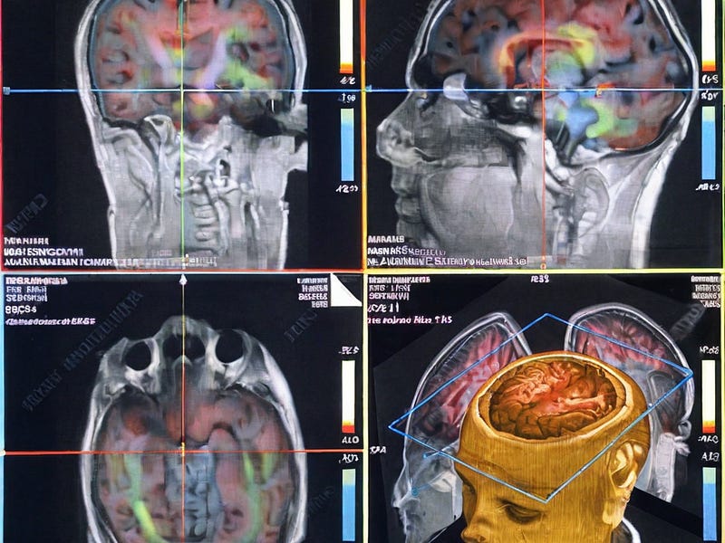 Insights into neuroscience through BCIs