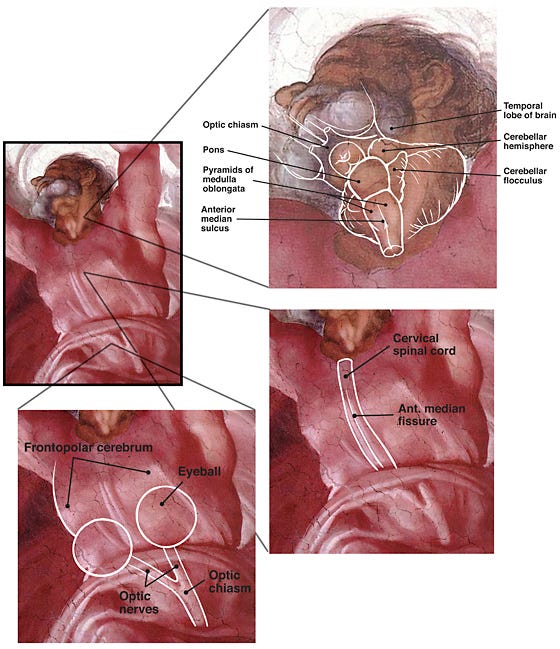 Composite view of neuroanatomical images in art